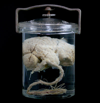 Bisected Human Brain in Antique Whitall Tatum Jar - Paxton Gate