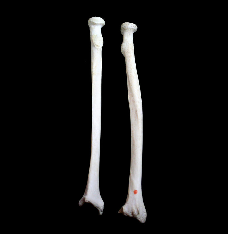 Human Radius Arm Bone - Paxton Gate