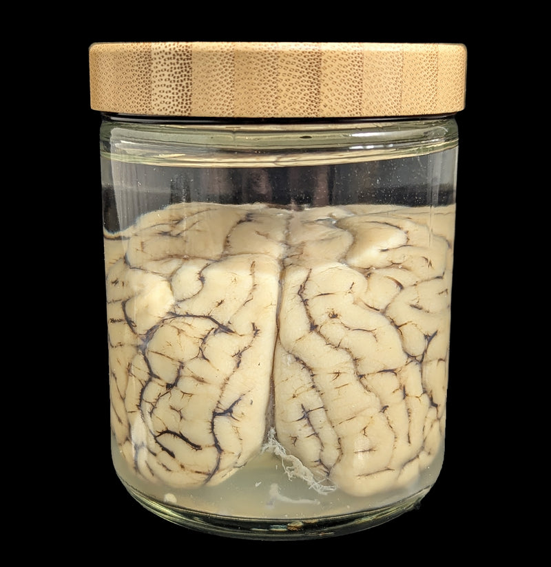 Sheep Brain Wet Specimen-WetSpecimn-Mz. Jones&
