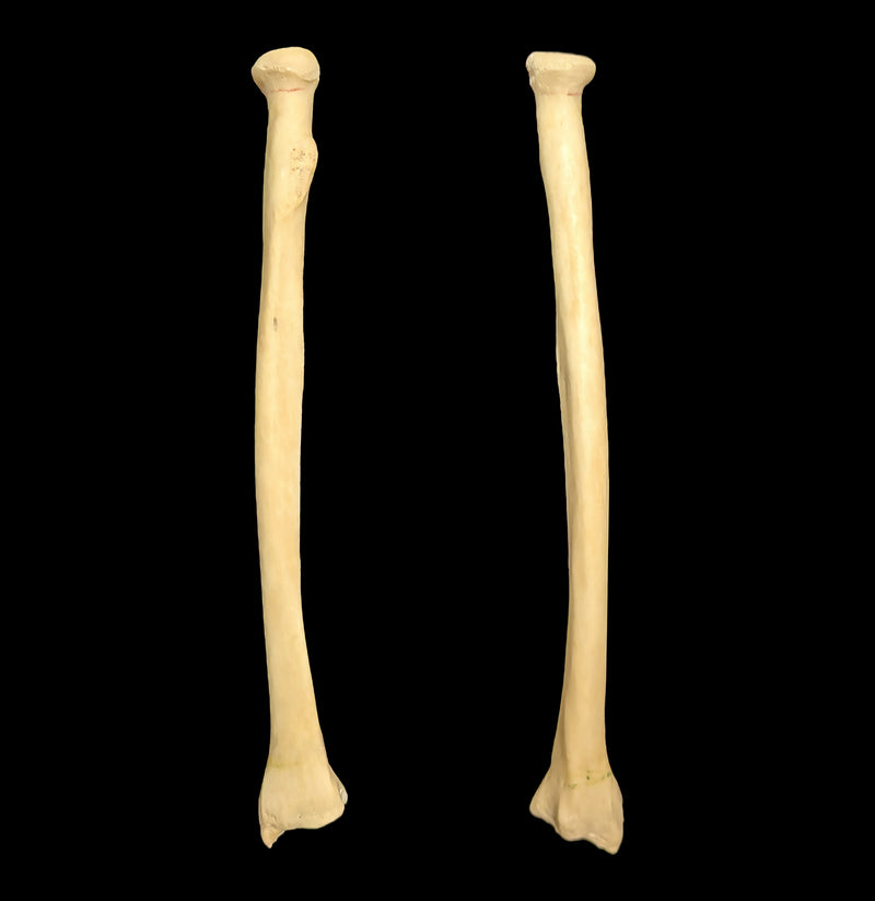 Human Radius-Skulls & Bones-Jennifer Jones-PaxtonGate