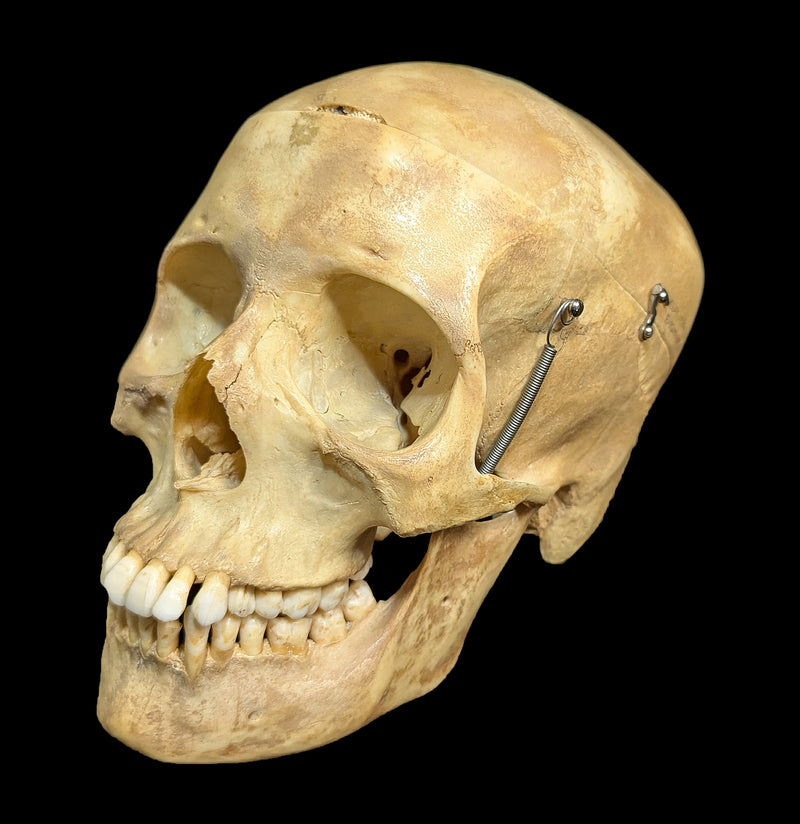 Human Skull Medical Specimen-Skulls & Bones-Jennifer Jones-PaxtonGate