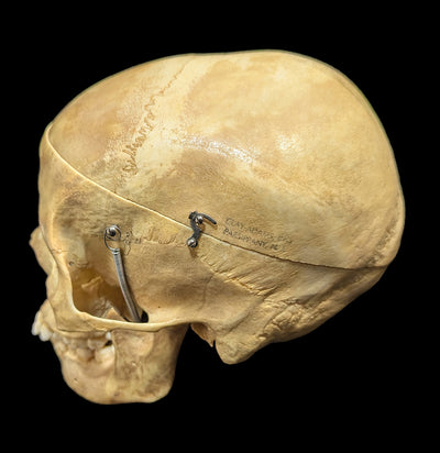 Human Skull Medical Specimen-Skulls & Bones-Jennifer Jones-PaxtonGate