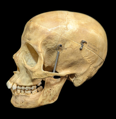 Human Skull Medical Specimen-Skulls & Bones-Jennifer Jones-PaxtonGate