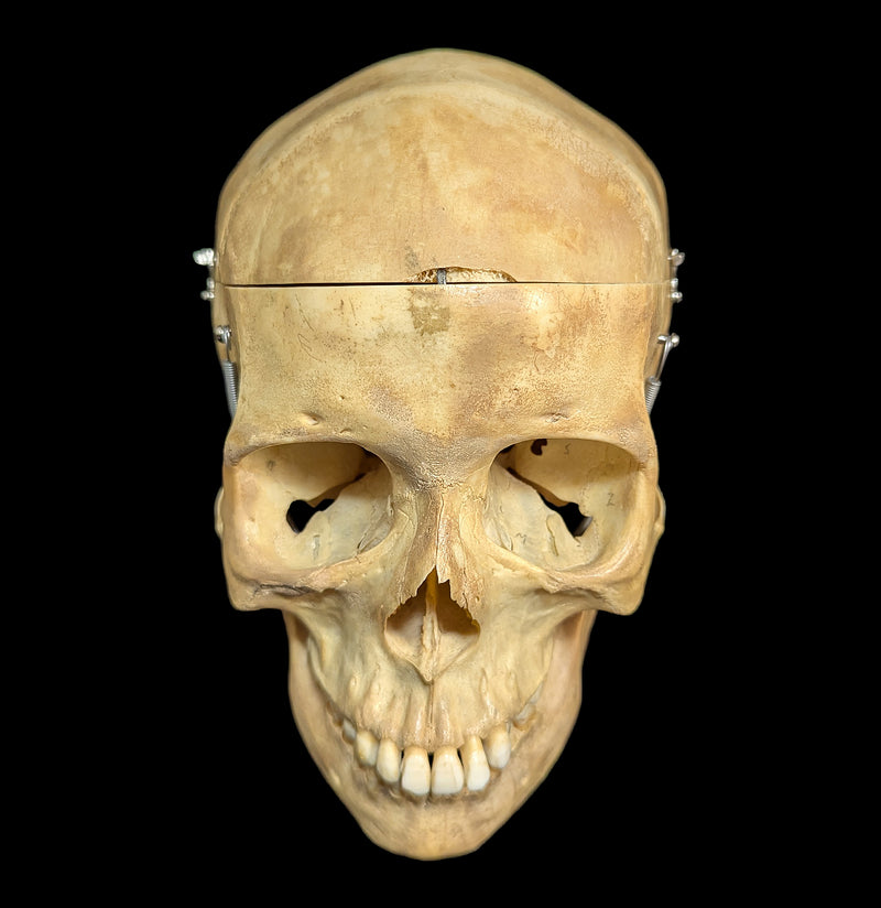 Human Skull Medical Specimen-Skulls & Bones-Jennifer Jones-PaxtonGate