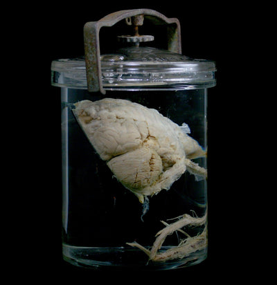 Bisected Human Brain in Antique Whitall Tatum Jar - Paxton Gate